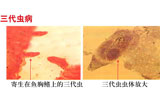 三代蟲(chóng)病
