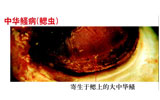 中華鳋病